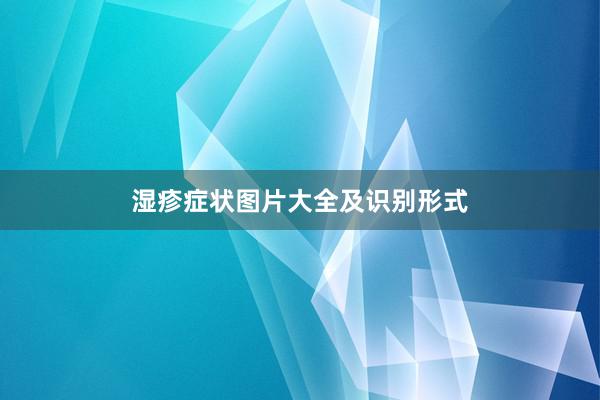 湿疹症状图片大全及识别形式